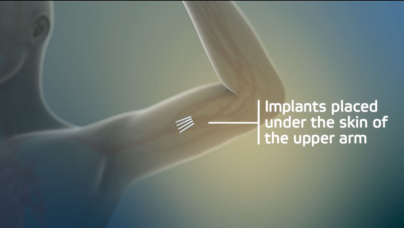 Image: Braeburn Pharmaceuticals